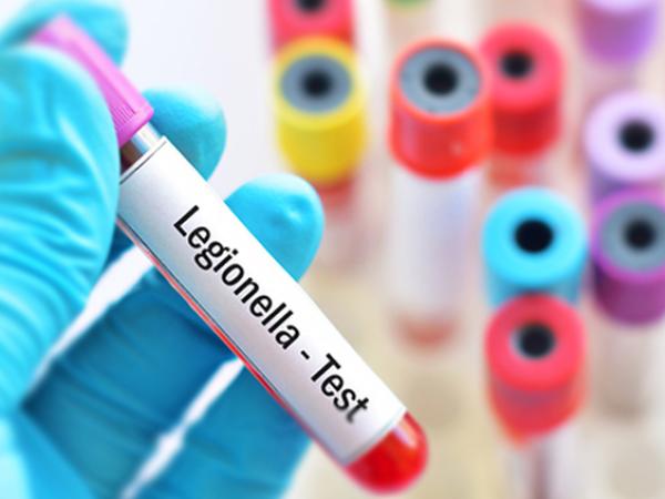 control de calidad del agua